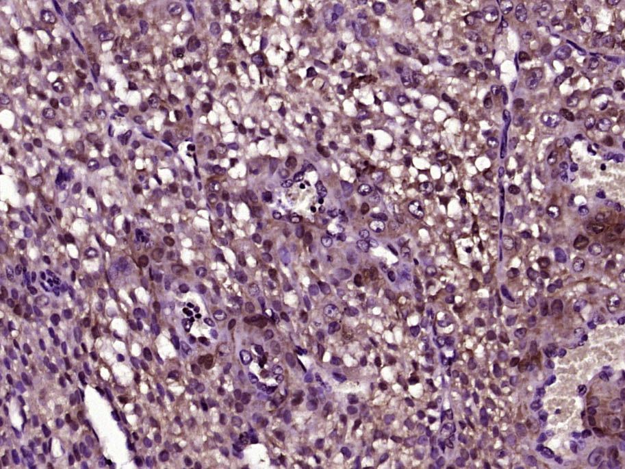 Fig1: Paraformaldehyde-fixed, paraffin embedded (Mouse embryos); Antigen retrieval by boiling in sodium citrate buffer (pH6.0) for 15min; Block endogenous peroxidase by 3% hydrogen peroxide for 20 minutes; Blocking buffer (normal goat serum) at 37℃ for 30min; Antibody incubation with (Osterix) Polyclonal Antibody, Unconjugated at 1:400 overnight at 4℃, followed by operating according to SP Kit(Rabbit) (sp-0023) instructionsand DAB staining.