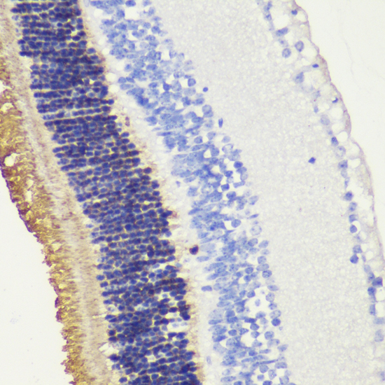 Immunohistochemistry - RHO Polyclonal Antibody 