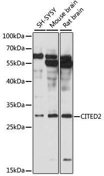 Western blot - CITED2 Polyclonal Antibody 