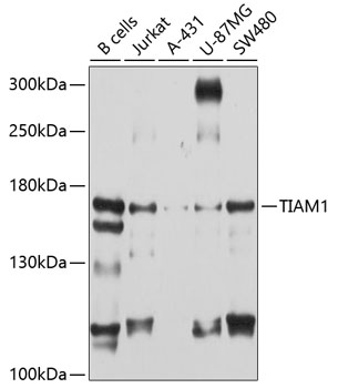 Western blot - TIAM1 Polyclonal Antibody 