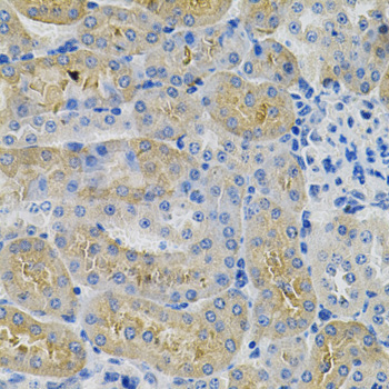 Immunohistochemistry - ANGPTL3 Polyclonal Antibody 