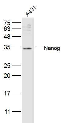 Fig5: Sample:; A431(Human) Cell Lysate at 30 ug; Primary: Anti-Nanog at 1/300 dilution; Secondary: IRDye800CW Goat Anti-Rabbit IgG at 1/20000 dilution; Predicted band size: 34 kD; Observed band size: 34 kD