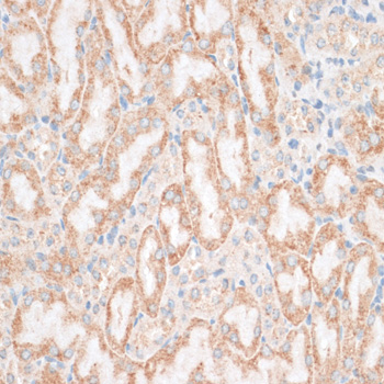 Immunohistochemistry - HMGA1 Polyclonal Antibody 