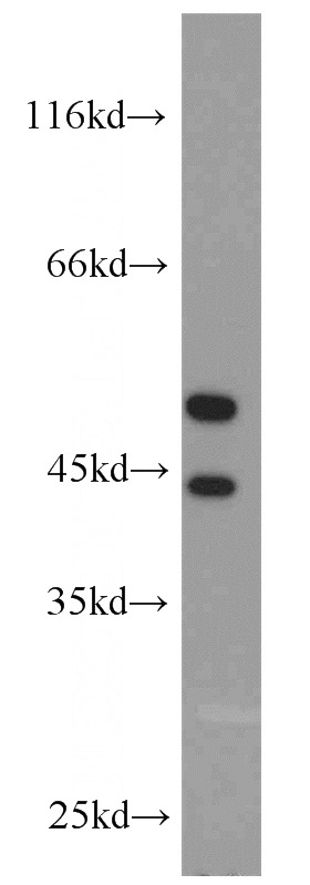 HeLa cells were subjected to SDS PAGE followed by western blot with Catalog No:111894(JNK2 antibody) at dilution of 1:1000