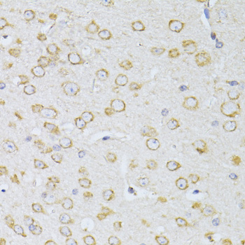 Immunohistochemistry - NTS Polyclonal Antibody 