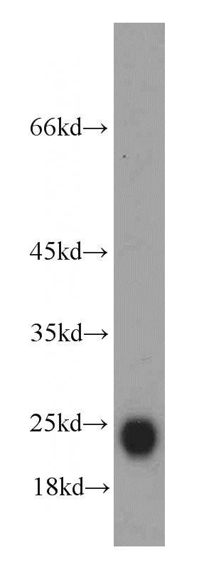 human testis tissue were subjected to SDS PAGE followed by western blot with Catalog No:111024(GLIPR1L1 antibody) at dilution of 1:500