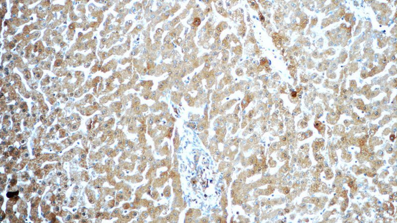 Immunohistochemistry of paraffin-embedded human liver tissue slide using Catalog No:115705(STEAP3 Antibody) at dilution of 1:50 (under 10x lens)