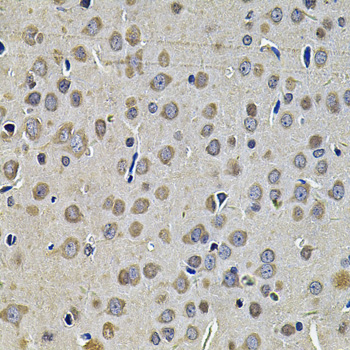 Immunohistochemistry - DNAJA3 Polyclonal Antibody 