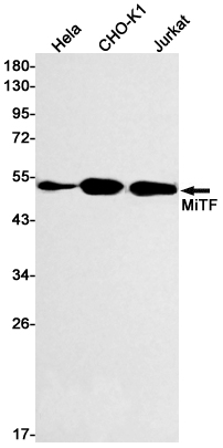 Western blot detection of MiTF in Hela,CHO-K1,Jurkat cell lysates using MiTF Rabbit mAb(1:500 diluted).Predicted band size:59kDa.Observed band size:52kDa.