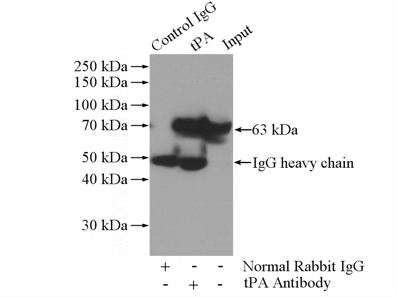 IP Result of anti-PLAT (IP:Catalog No:116260, 3ug; Detection:Catalog No:116260 1:1000) with mouse kidney tissue lysate 4000ug.