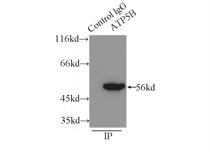 IP Result of anti-ATPB (IP:Catalog No:108322, 3ug; Detection:Catalog No:108322 1:500) with mouse heart tissue lysate 7500ug.