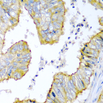 Immunohistochemistry - KRBOX4 Polyclonal Antibody 