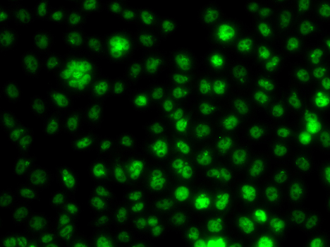 Immunofluorescence - UBE2R2 Polyclonal Antibody 