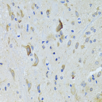 Immunohistochemistry - SARS Polyclonal Antibody 