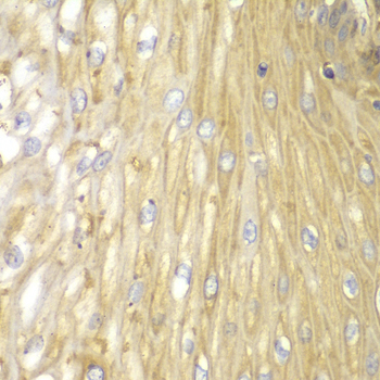 Immunohistochemistry - PPP2R2A Polyclonal Antibody 