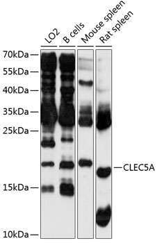 Western blot - CLEC5A Polyclonal Antibody 