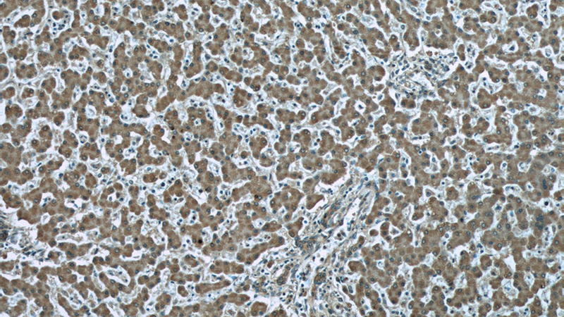 Immunohistochemistry of paraffin-embedded human liver tissue slide using Catalog No:107407(LONP1 Antibody) at dilution of 1:50(under 10x lens)