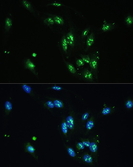 Immunofluorescence - CCDC59 Polyclonal Antibody 
