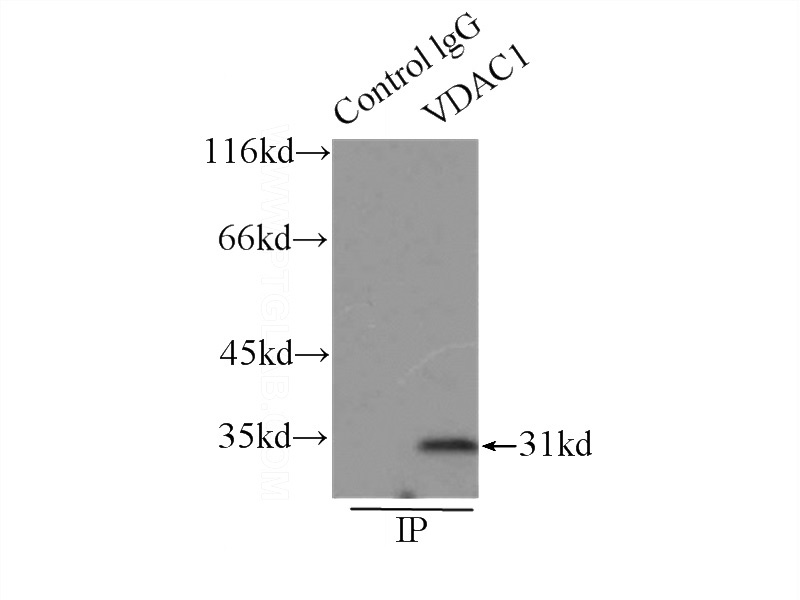 IP Result of anti-VDAC1 (IP:Catalog No:117345, 3ug; Detection:Catalog No:117345 1:1000) with mouse skeletal muscle tissue lysate 7500ug.