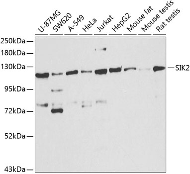 Western blot - SIK2 Polyclonal Antibody 