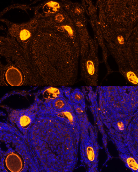 Immunofluorescence - ZP2 Polyclonal Antibody 