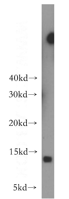 human spleen tissue were subjected to SDS PAGE followed by western blot with Catalog No:112346(LSM10 antibody) at dilution of 1:200