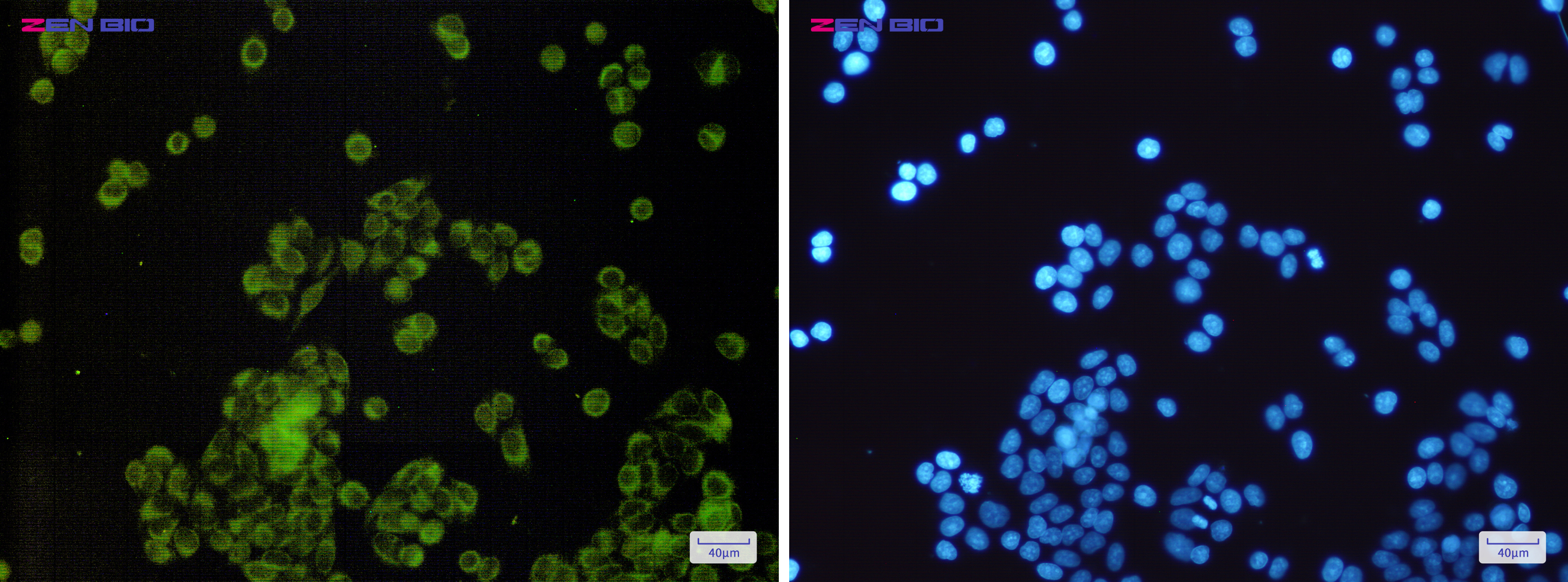 Immunocytochemistry of SLC27A4/FATP4(green) in Hela cells using SLC27A4/FATP4 Rabbit mAb at dilution 1/200, and DAPI(blue)