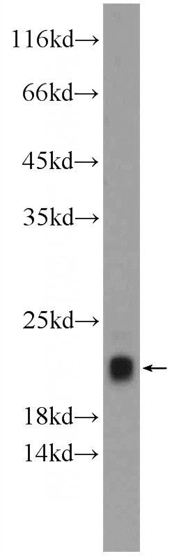mouse skeletal muscle tissue were subjected to SDS PAGE followed by western blot with Catalog No:116149(TNNC2 Antibody) at dilution of 1:600