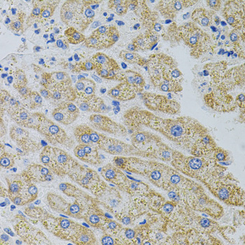 Immunohistochemistry - CRHR2 Polyclonal Antibody 