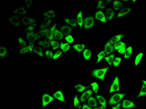 Immunofluorescence - IGFBP5 Polyclonal Antibody 