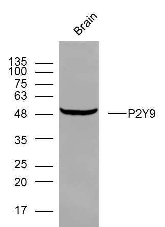 Fig3: Sample: Brain (mouse) Lysate at 40 ug; Primary: Anti- P2Y9 at 1/300 dilution; Secondary: IRDye800CW Goat Anti-Rabbit IgG at 1/20000 dilution; Predicted band size: 42 kD; Observed band size: 48 kD