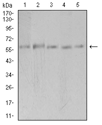 Fig3: Western blot analysis of PAK3 on different cell lysate using anti-PAK3 antibody at 1/1,000 dilution.; Positive control: Line1: Hela Line2: SK-N-SH Line3: T47D Line4: COS7 Line5: HepG2