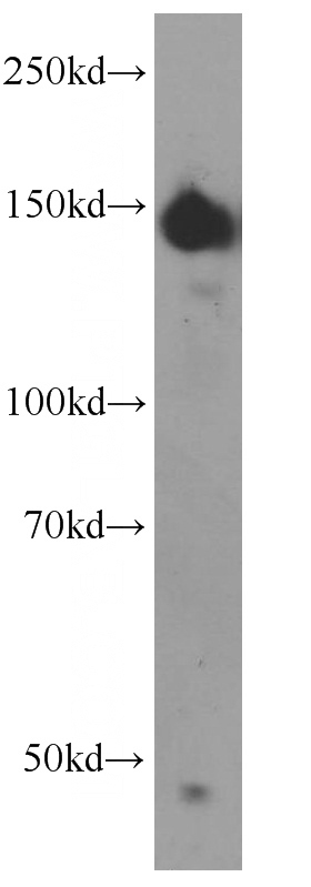 human brain tissue were subjected to SDS PAGE followed by western blot with Catalog No:109334(CLASP2 antibody) at dilution of 1:500