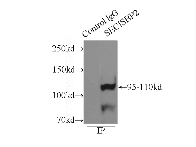 IP Result of anti-SECISBP2 (IP:Catalog No:115092, 3ug; Detection:Catalog No:115092 1:600) with mouse testis tissue lysate 8000ug.