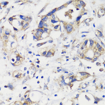 Immunohistochemistry - DEPDC6 Polyclonal Antibody 