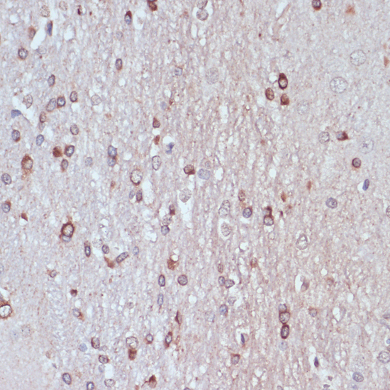 Immunohistochemistry - TPD52 Polyclonal Antibody 