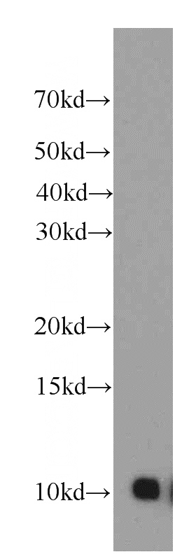 HepG2 cells were subjected to SDS PAGE followed by western blot with Catalog No:115595(SRP9 antibody) at dilution of 1:1000