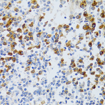 Immunohistochemistry - CHAF1B Polyclonal Antibody 