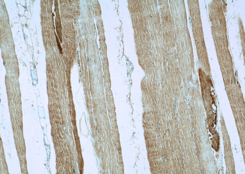 Immunohistochemical of paraffin-embedded human skeletal muscle using Catalog No:107831(AGPAT1 antibody) at dilution of 1:50 (under 10x lens)