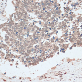 Immunohistochemistry - ZNF562 Polyclonal Antibody 