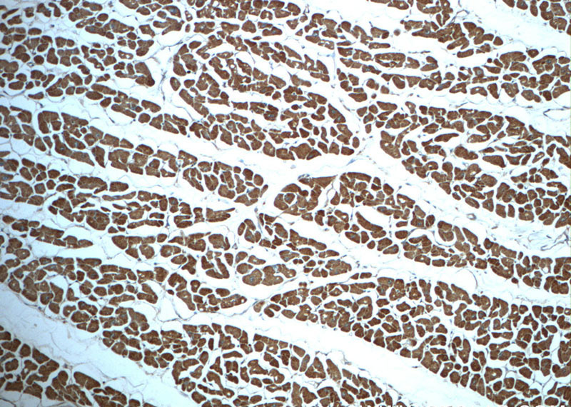 Immunohistochemistry of paraffin-embedded human heart slide using Catalog No:113624(PDK1 Antibody) at dilution of 1:50