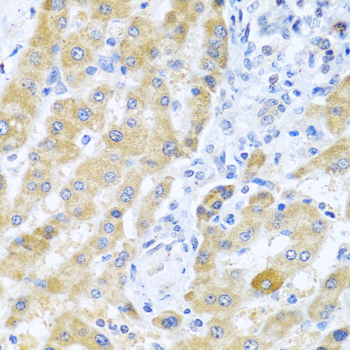 Immunohistochemistry - Gm13125 Polyclonal Antibody 