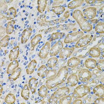 Immunohistochemistry - GLA Polyclonal Antibody 