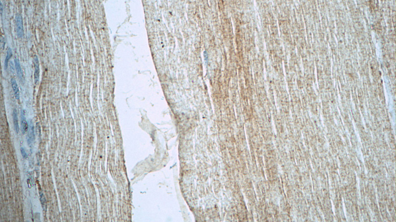 Immunohistochemistry of paraffin-embedded human skeletal muscle tissue slide using Catalog No:112998(MYOZ3 Antibody) at dilution of 1:50 (under 40x lens)