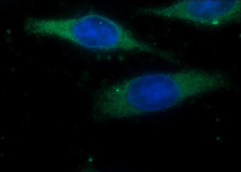 Immunofluorescent analysis of HeLa cells using Catalog No:113520(OVCA1 Antibody) at dilution of 1:50 and Alexa Fluor 488-congugated AffiniPure Goat Anti-Rabbit IgG(H+L)