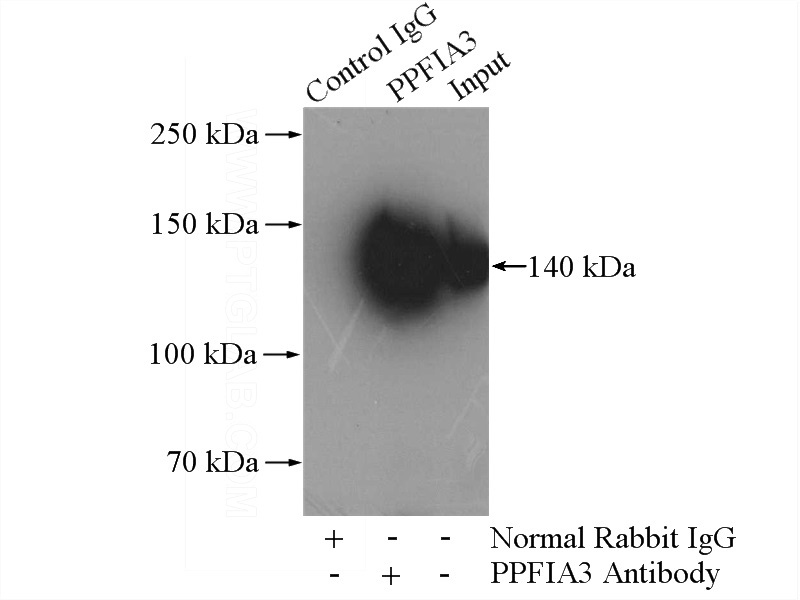 IP Result of anti-PPFIA3 (IP:Catalog No:114120, 4ug; Detection:Catalog No:114120 1:600) with mouse brain tissue lysate 3440ug.