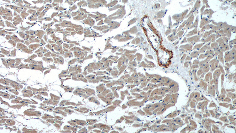 Immunohistochemistry of paraffin-embedded human heart tissue slide using Catalog No:113131(NAV1 Antibody) at dilution of 1:200 (under 10x lens).