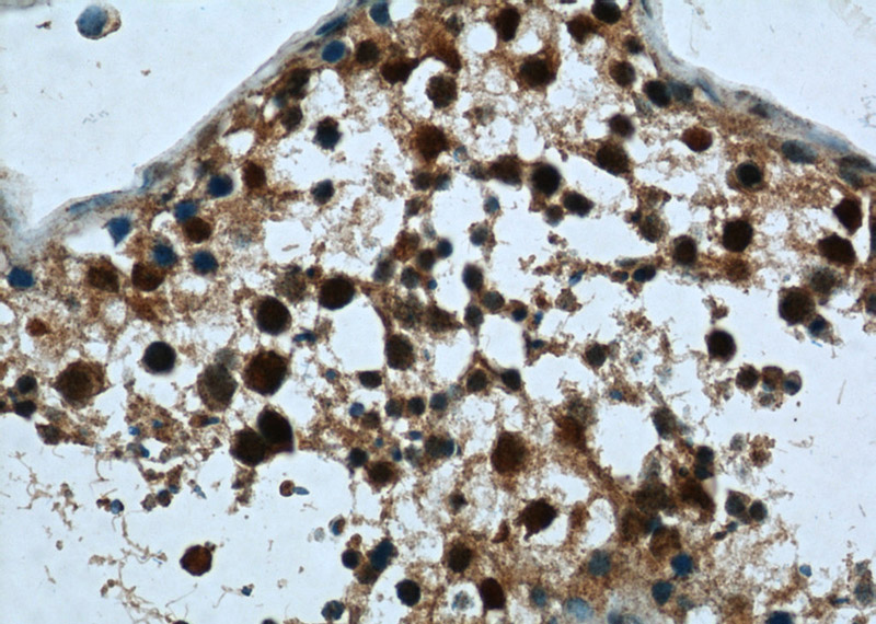 Immunohistochemistry of paraffin-embedded human testis tissue slide using Catalog No:109540 (CRCP Antibody) at dilution of 1:50 (under 40x lens)