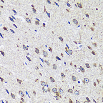 Immunohistochemistry - CCDC124 Polyclonal Antibody 