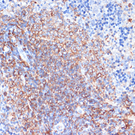 Immunohistochemistry - HLA-DRA Polyclonal Antibody 